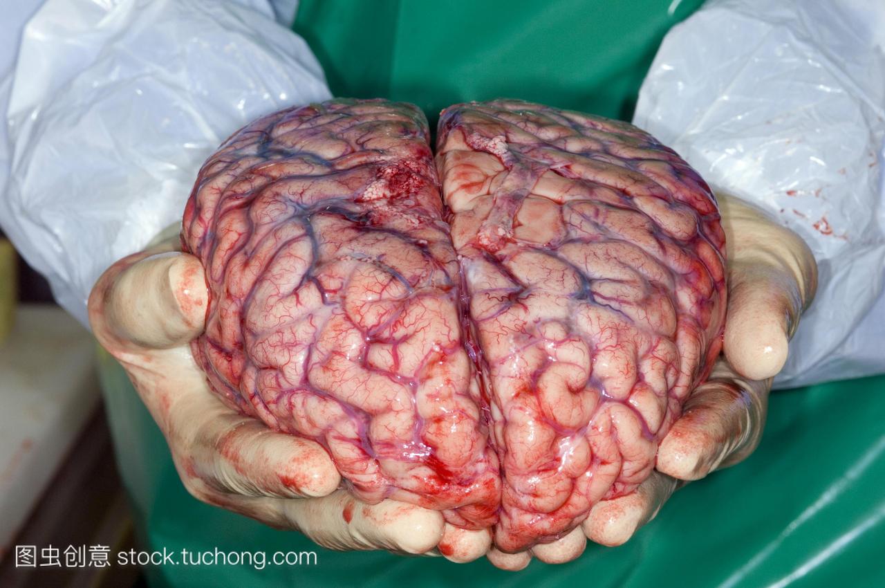 脑在事后显示其两个半球。位于头部大脑中枢神
