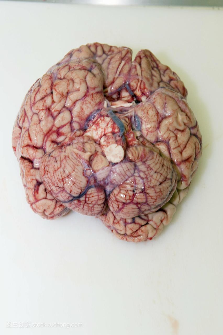 大脑验尸。大脑位于大脑的头部,是中枢神经系