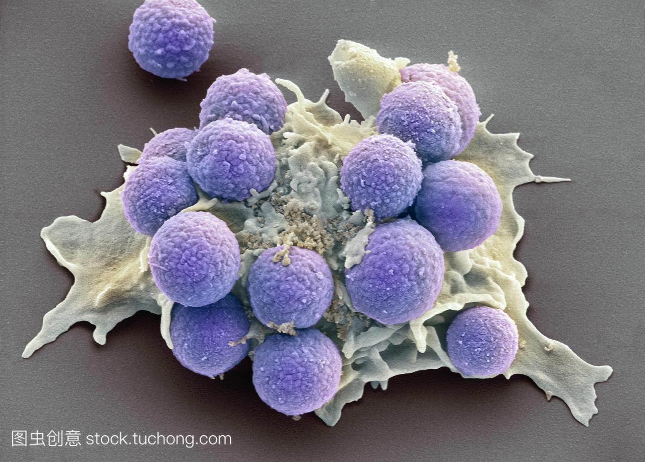吞噬作用的真菌孢子。彩色扫描电子显微摄影S