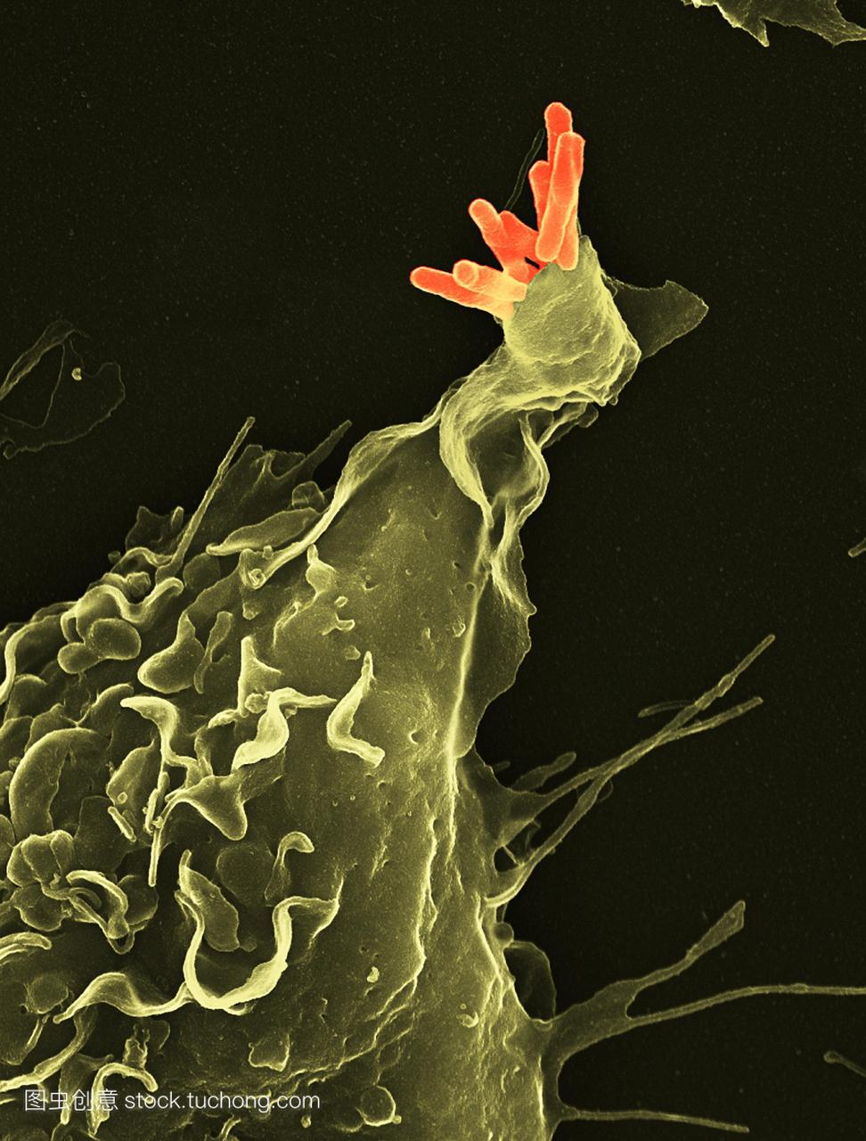 巨噬细胞吞噬结核疫苗。一种巨噬细胞白细胞绿