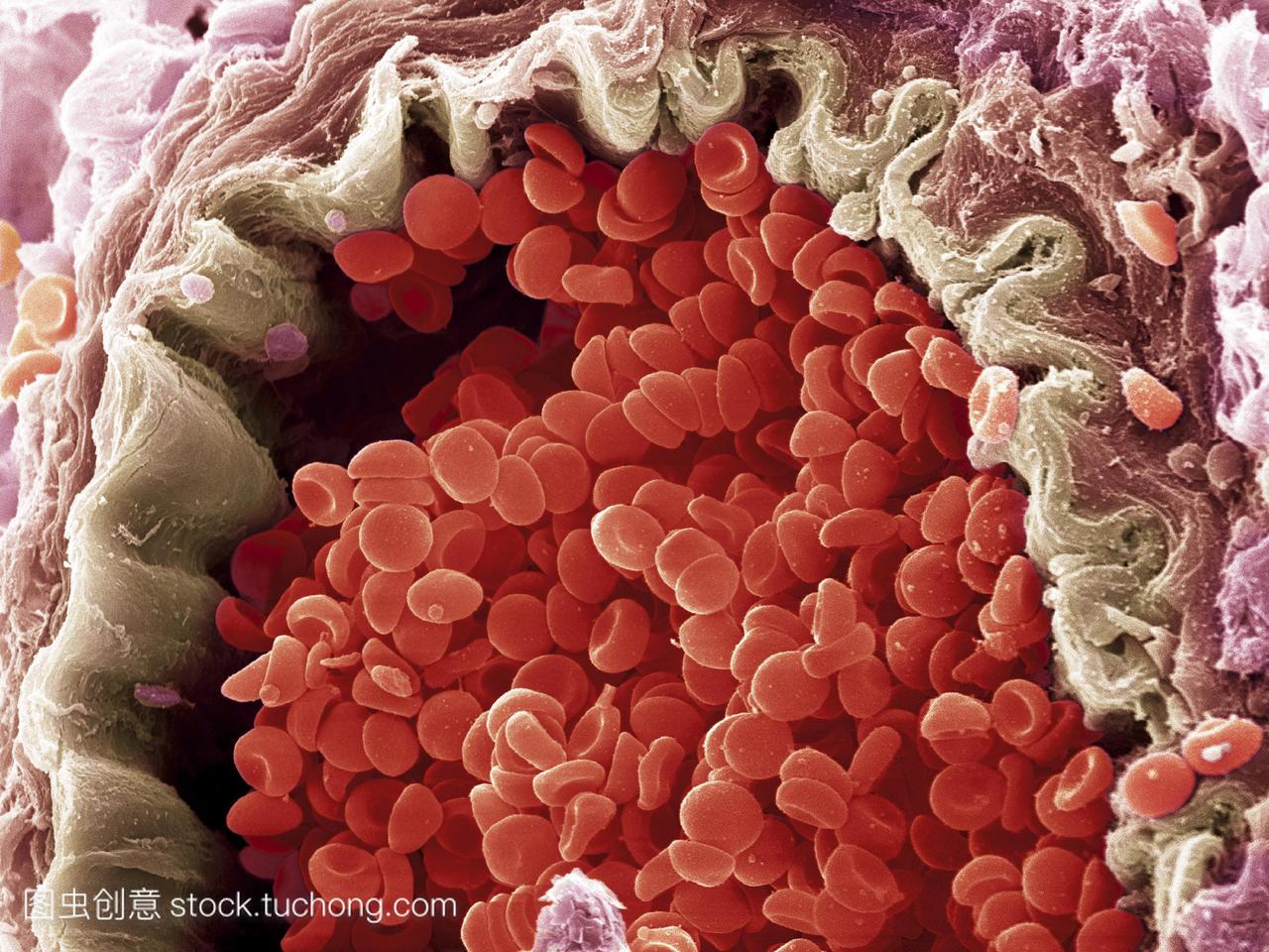 红细胞。红色血细胞红细胞的彩色扫描电子显微