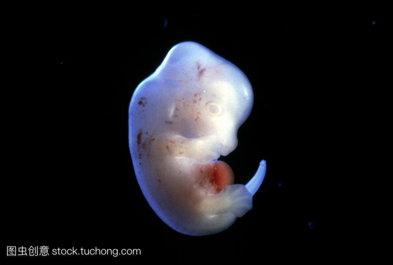 鼠胚胎155天。一个大鼠胚胎在15天妊娠期的特