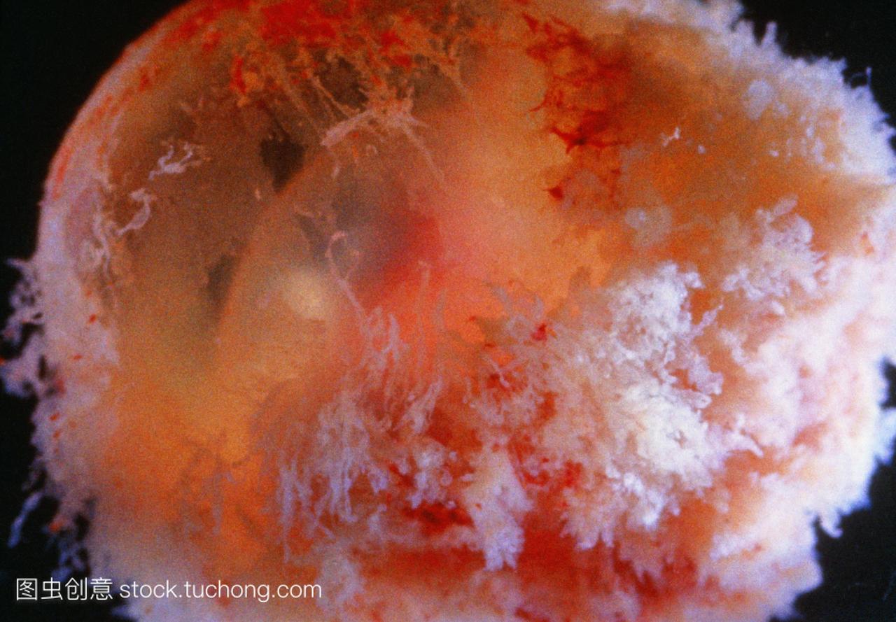 人类胚胎约为5-6周浆膜的保护层白色围绕发展