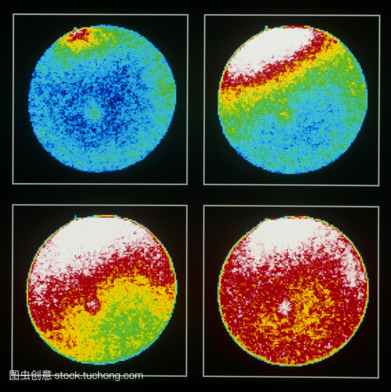 受精钙波4张图片。在受精过程中,一个精子左上