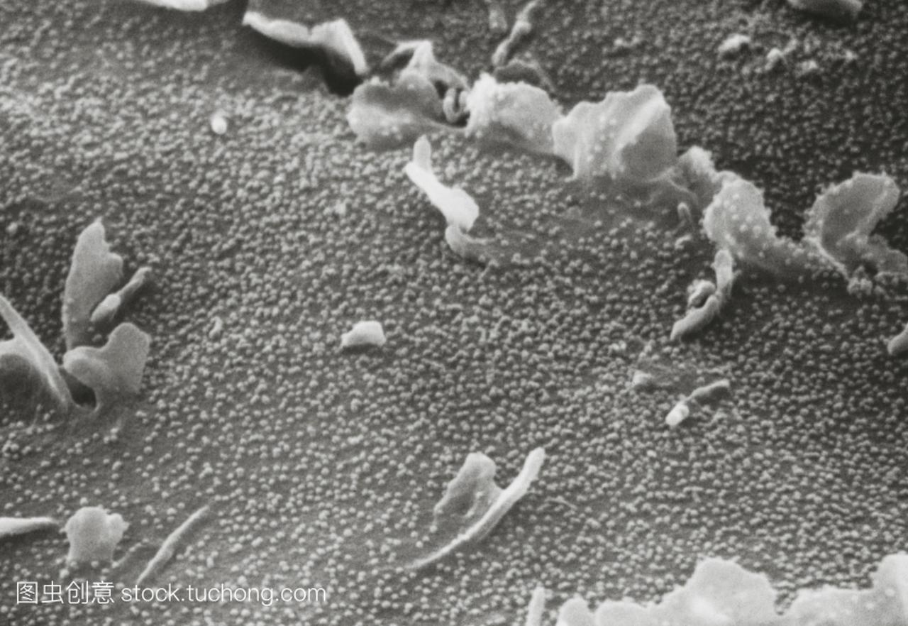 扫描电子显微照片的风疹病毒爆发点从受感染细
