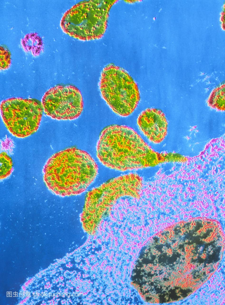 德国麻疹病毒的病毒粒子病毒粒子的假彩色透射
