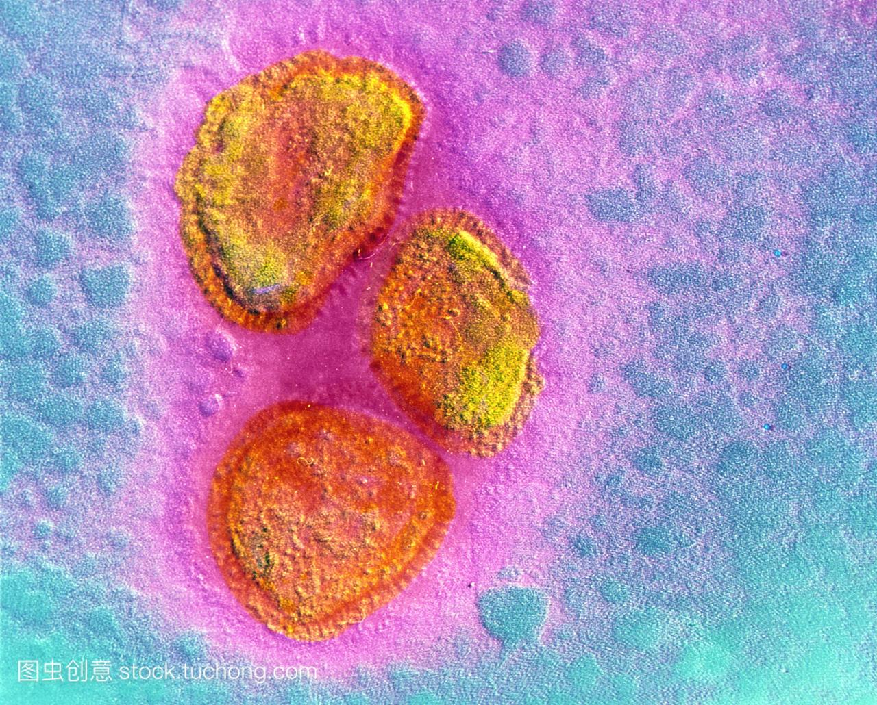 伪彩色透射电子显微镜TEM3病毒粒子腮腺炎病