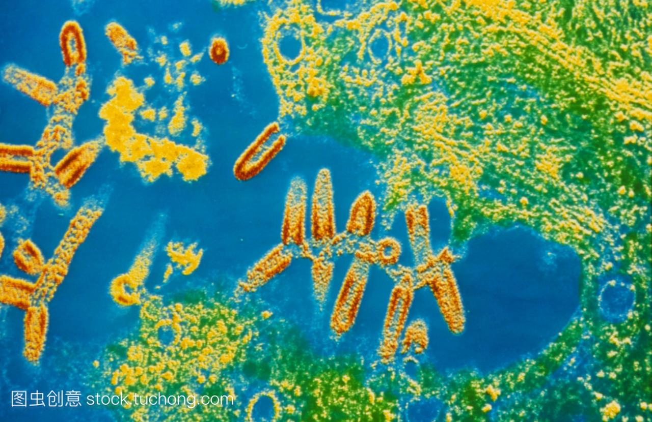 falsecolour狂犬病病毒粒子的透射电子显微图红