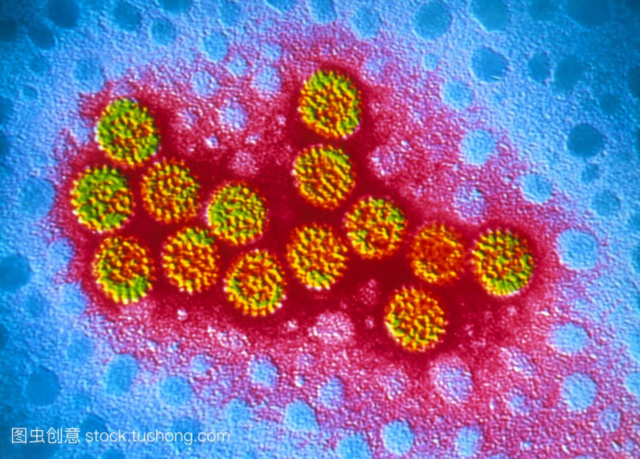 伪彩色透射电子显微镜TEM的病毒粒子的轮状
