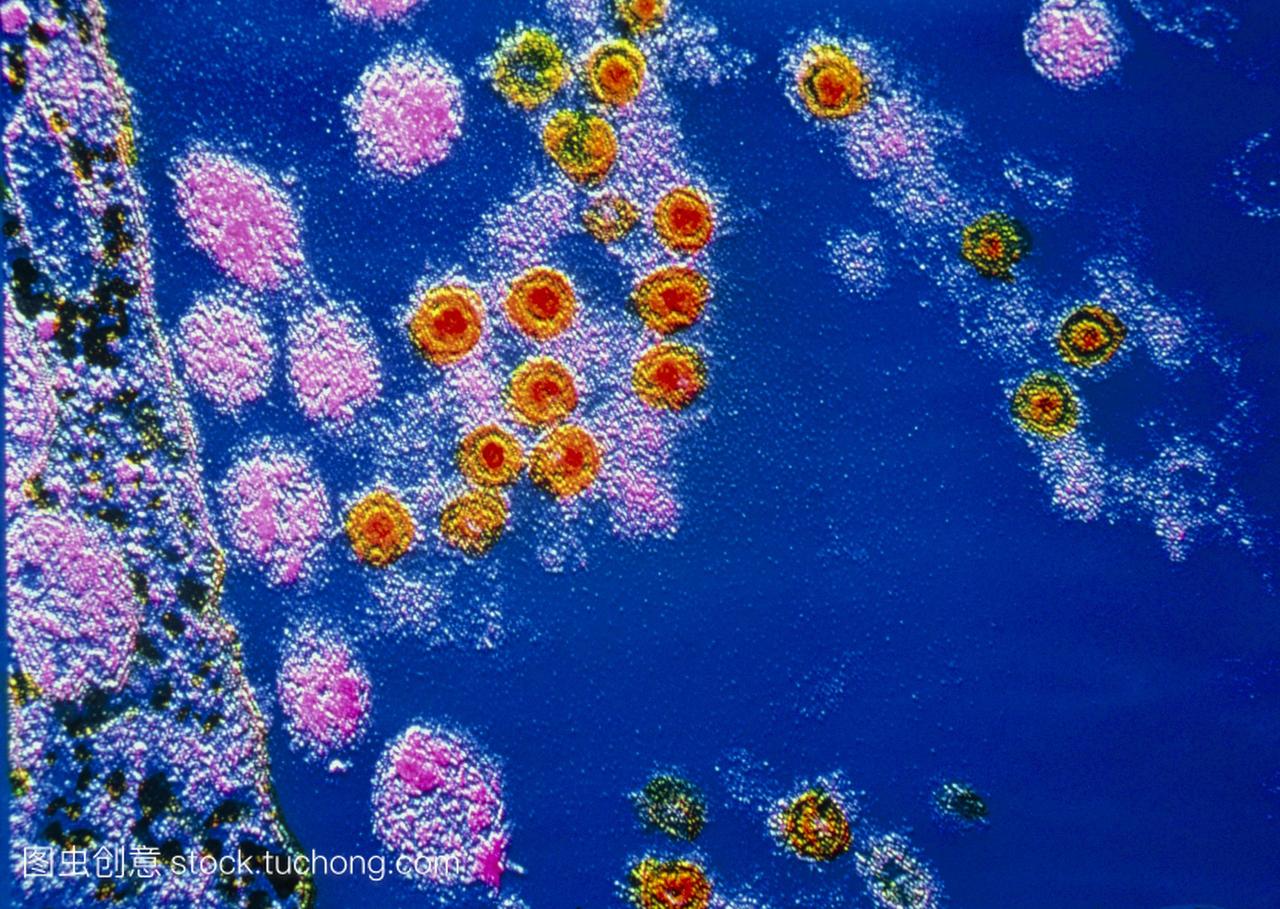 伪彩色透射电子显微镜TEM的病毒粒子风疹病
