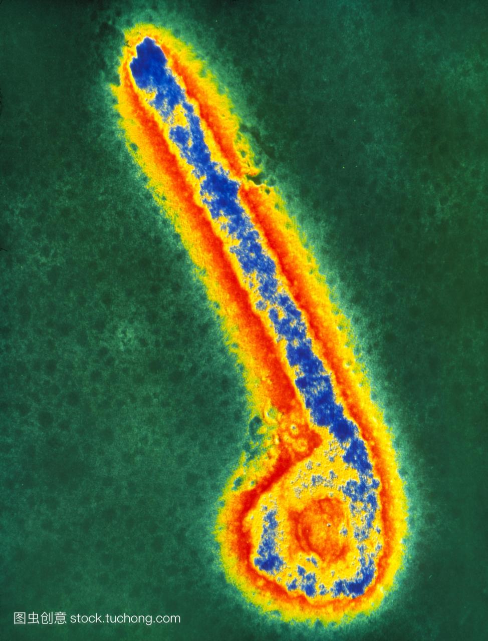 埃博拉病毒的伪彩色透射电子显微照片一群丝状