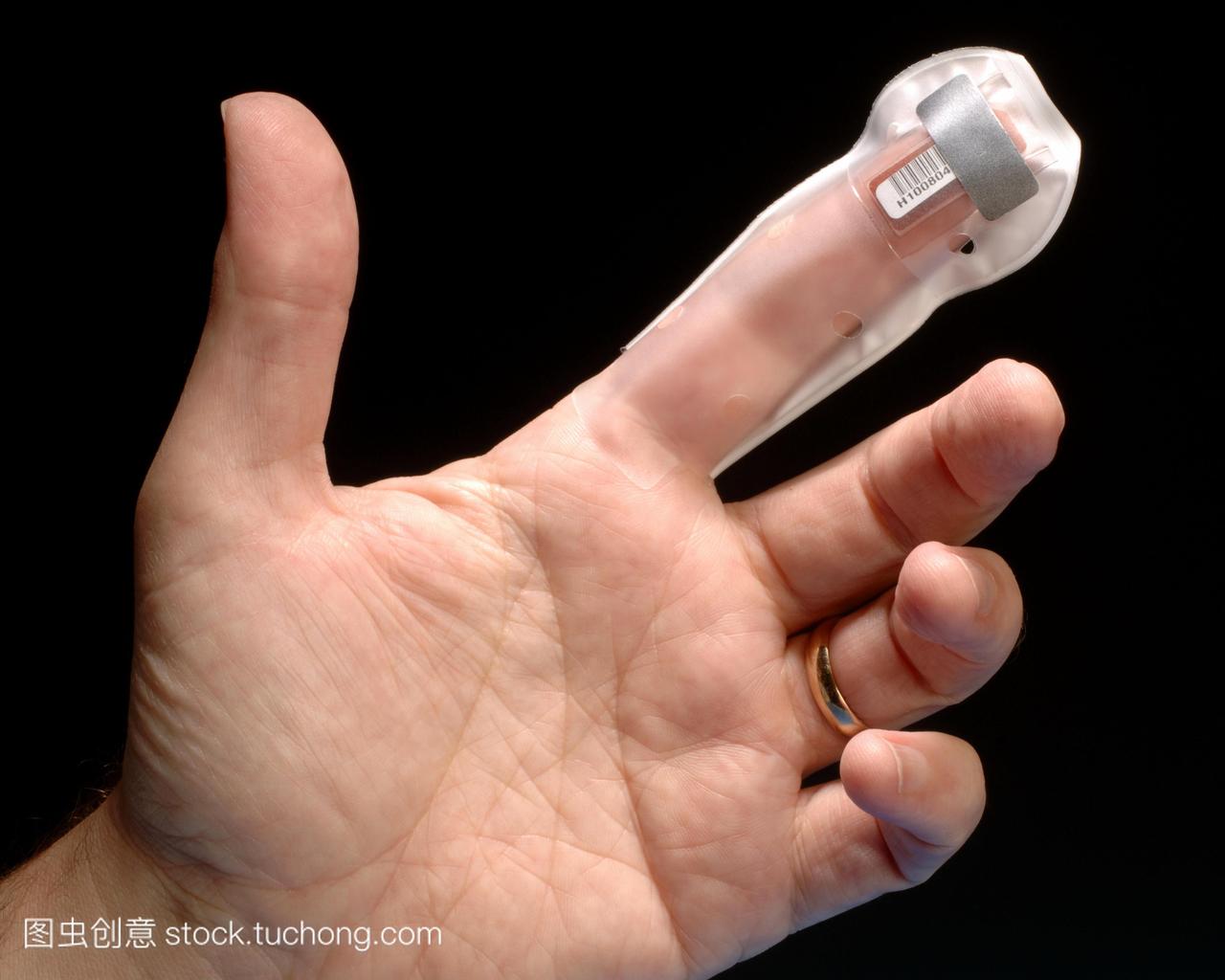 个人辐射监测在一个人的手指。这是一个极端T