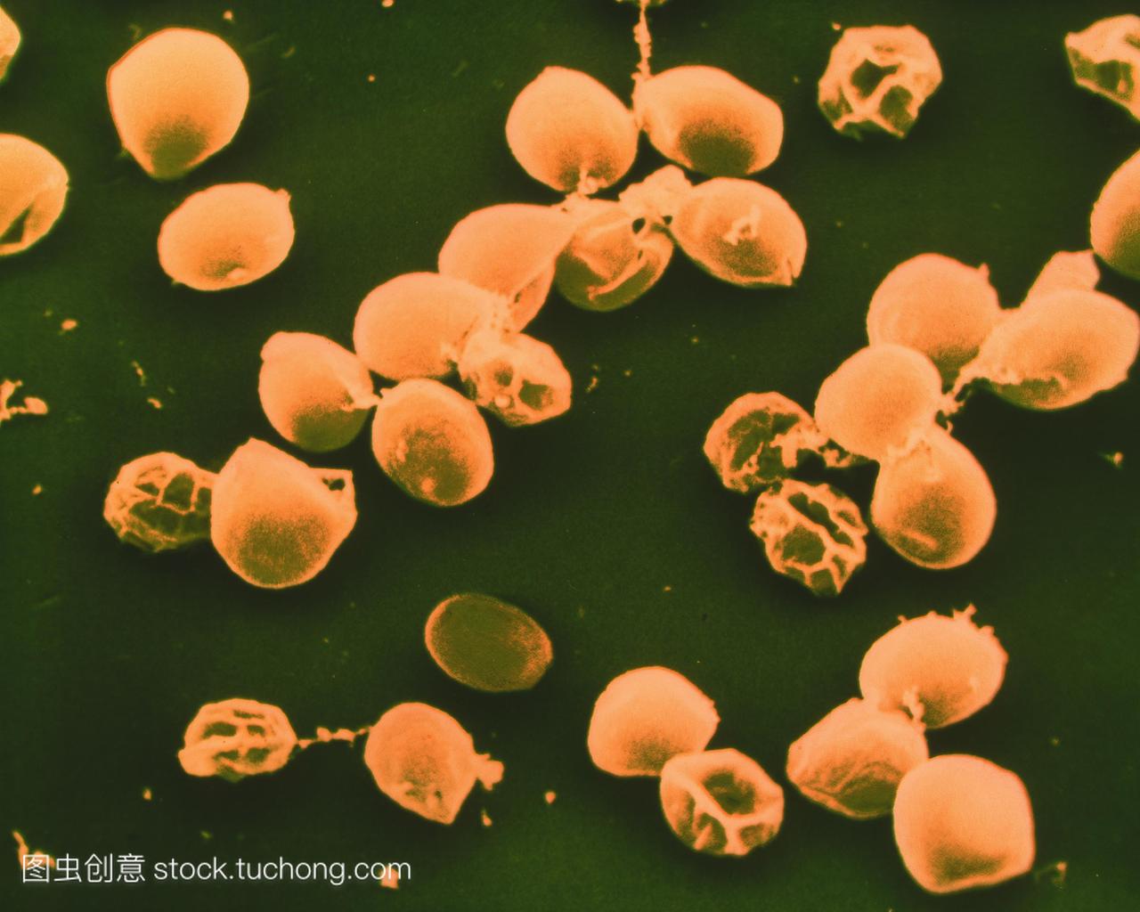 种寄生虫感染性孢子体阶段引起人类严重腹泻条