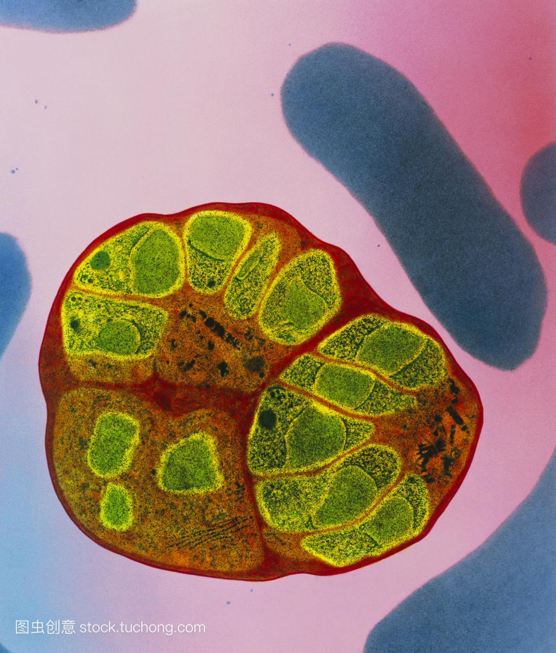 疟疾。彩色透射电子显微摄影人的血红细胞感染