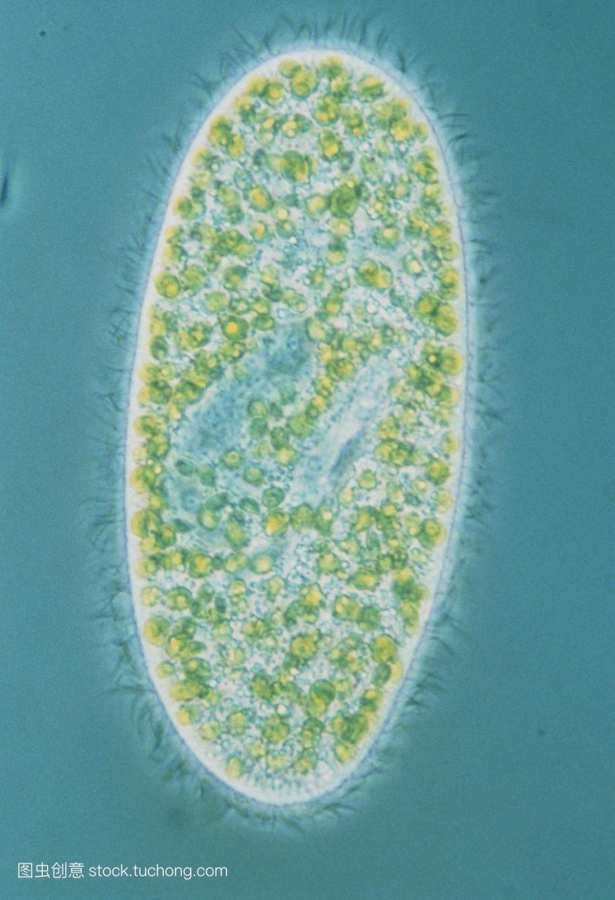 一个纤毛原生动物草履虫的光显微图。显微图是四个图像中的一个，说明了光学显微镜不同的照明系统。这是相位对比光学的一个例子，它降低了色彩饱和度，但是增加了在细胞的细胞质内可见的细节量。纤毛的边缘，或有机体周围的细毛，用这种技术可见。放大x150在35毫米大小。《微观世界》。192技术附件三左下技术信息相衬光学
