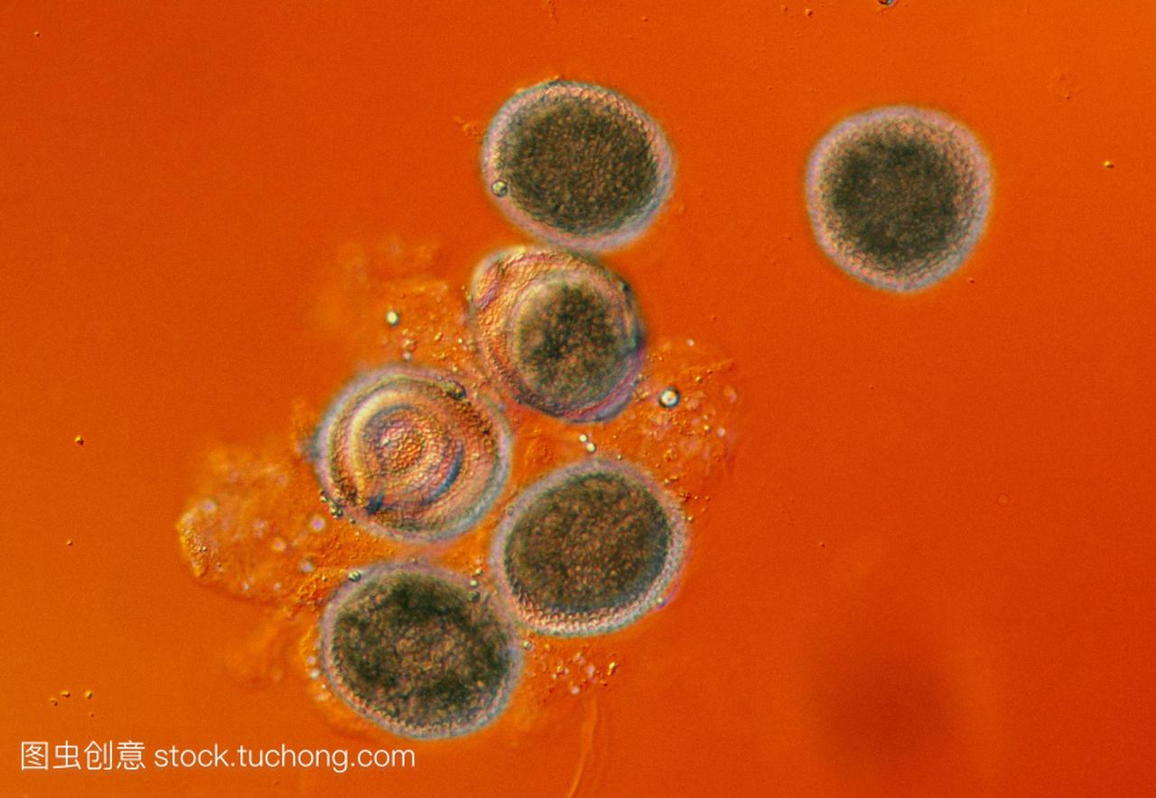 光显微照片的狗蛔虫犬弓蛔虫的卵。胚胎通过厚