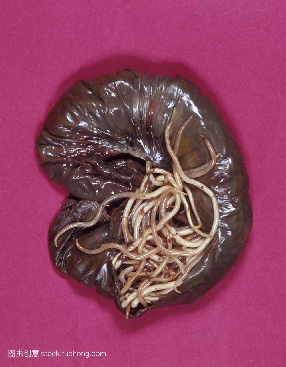 蛔虫阻塞。旋毛虫蛔虫线虫在肠道的大体标本中
