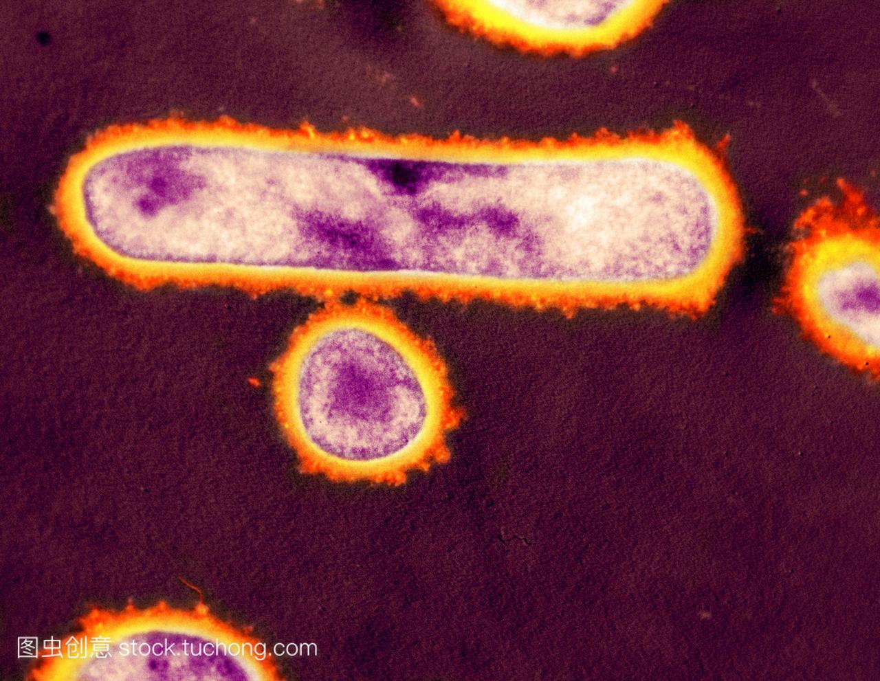干酪乳杆菌冻干细菌。彩色透射电子显微镜TE