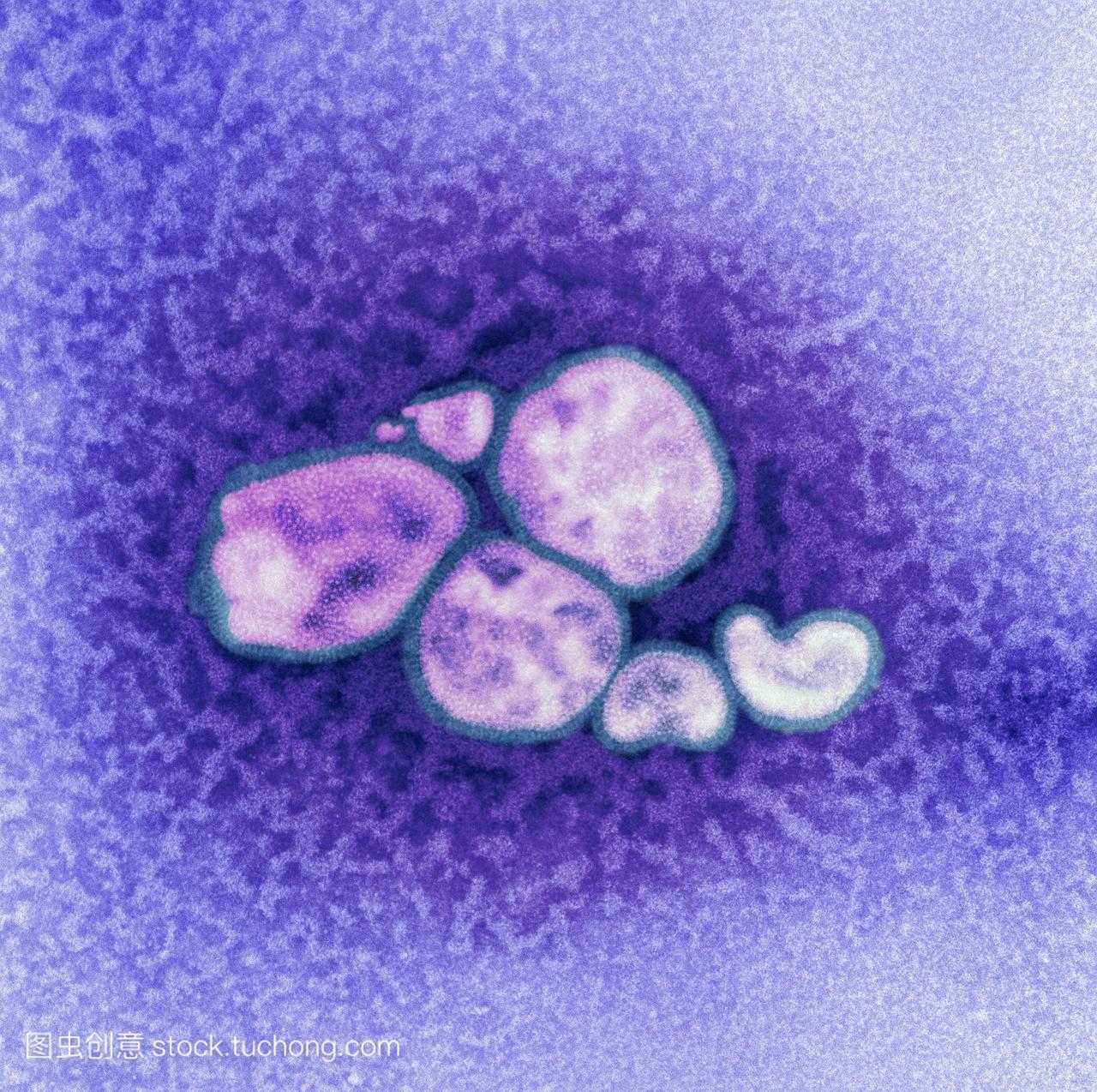 H1N1猪流感病毒。彩色透射电子显微镜TEM猪