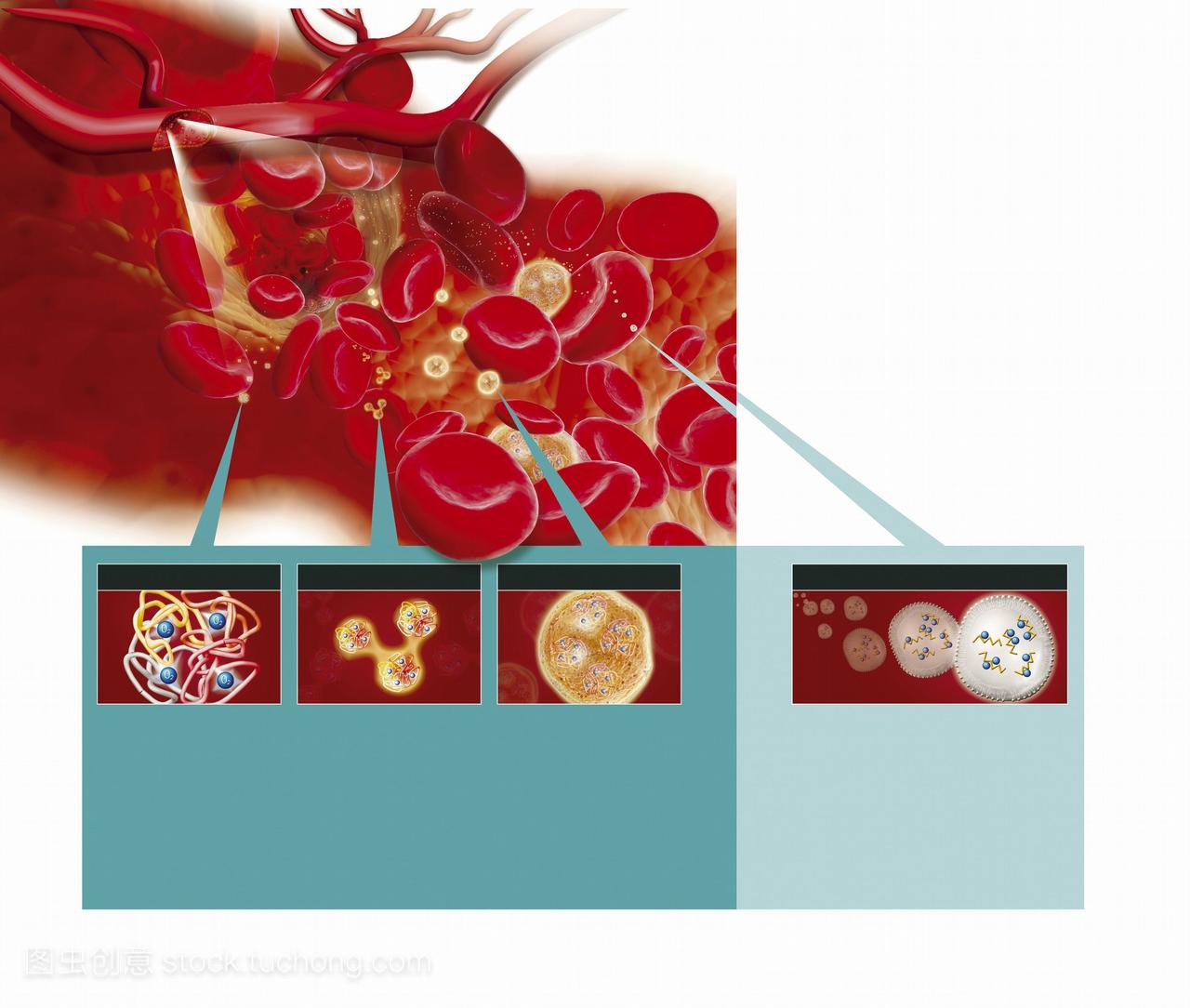 合成红细胞。计算机图形显示阶段血红蛋白生产