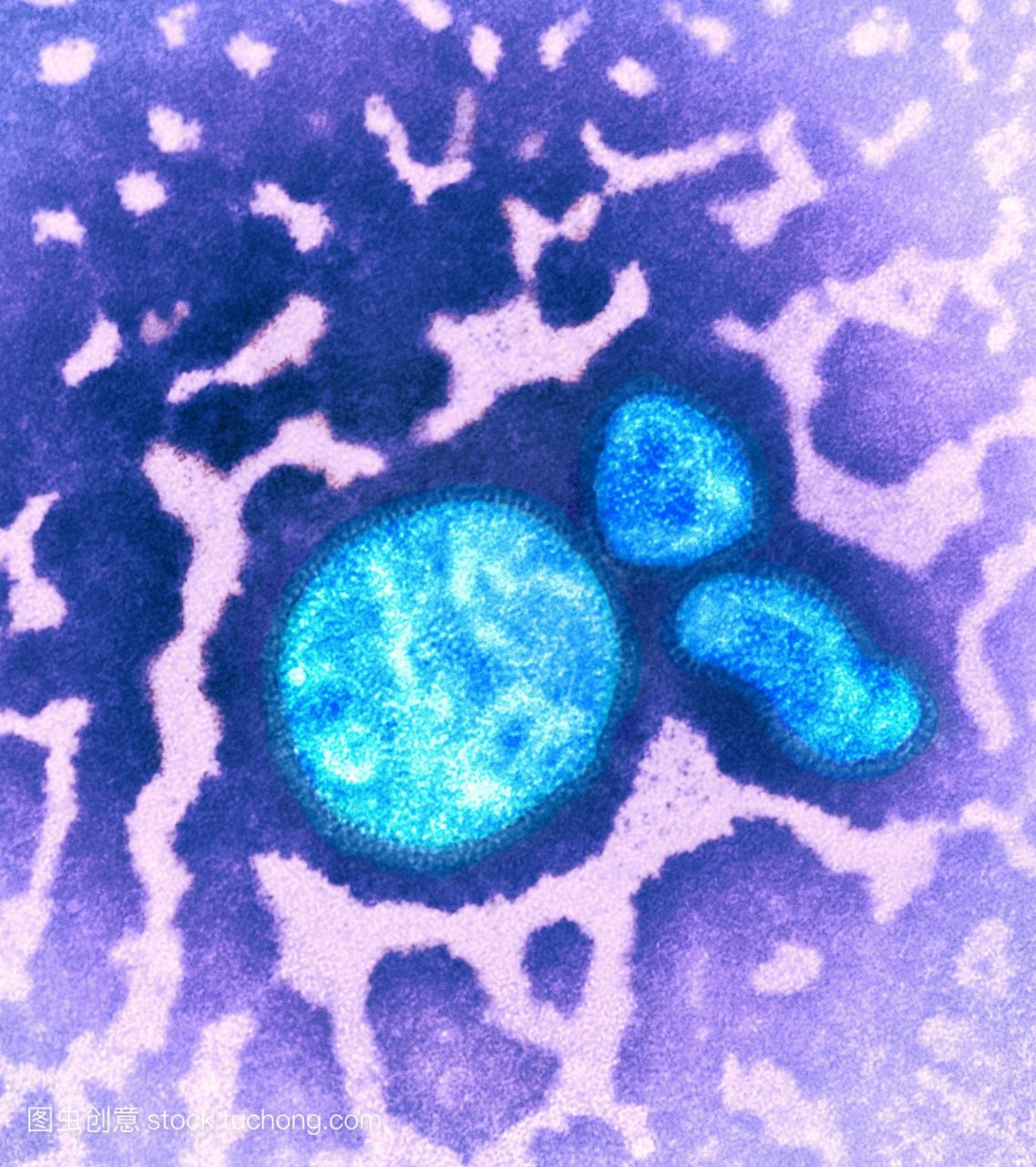h1n1猪流感病毒。从2009年4月起爆发的猪流感