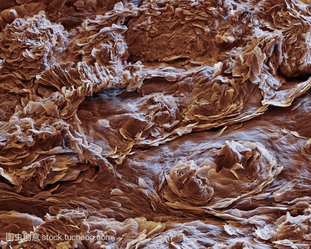 人类的舌头表面的细菌。彩色扫描电子显微摄影