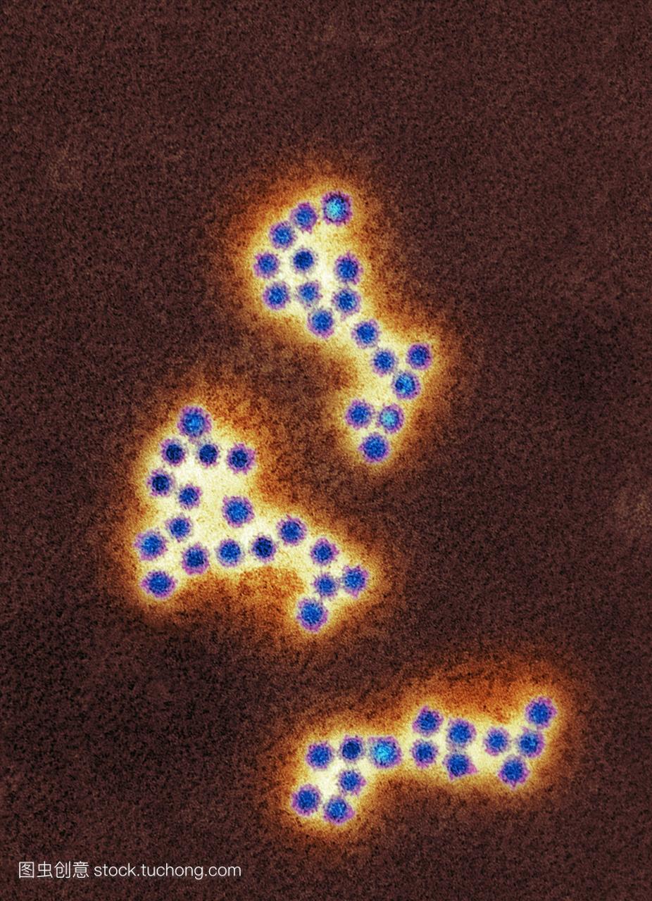 诺瓦克病毒粒子。诺瓦克病毒粒子的彩色透射电