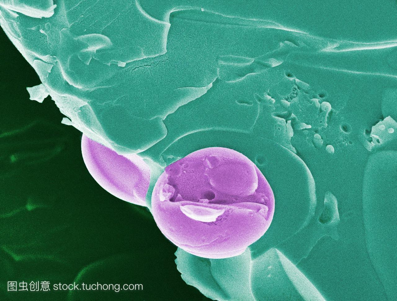 疟疾的血液细胞。彩色扫描电子显微照片sem,