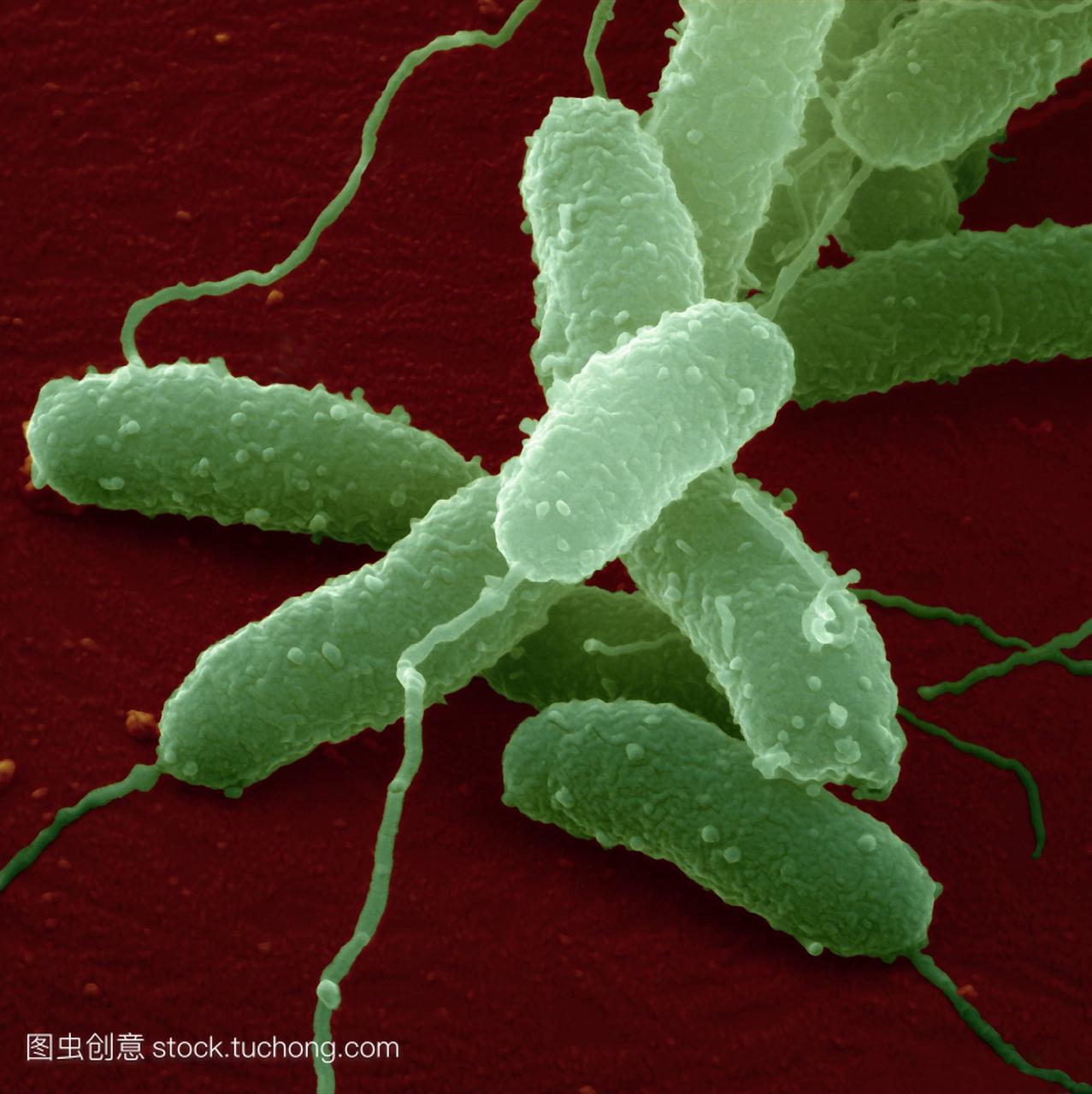 霍乱细菌。彩色扫描电子显微镜sem的弧菌。这