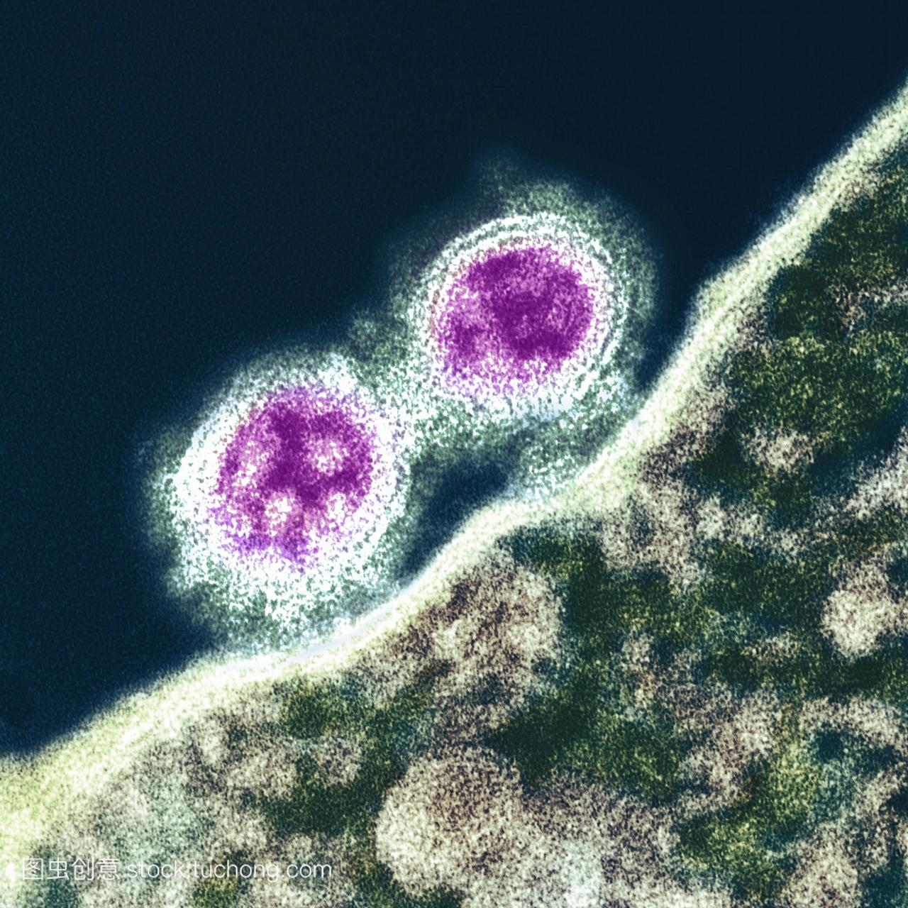 h1n1猪流感病毒。彩色透射电子显微镜tem通过
