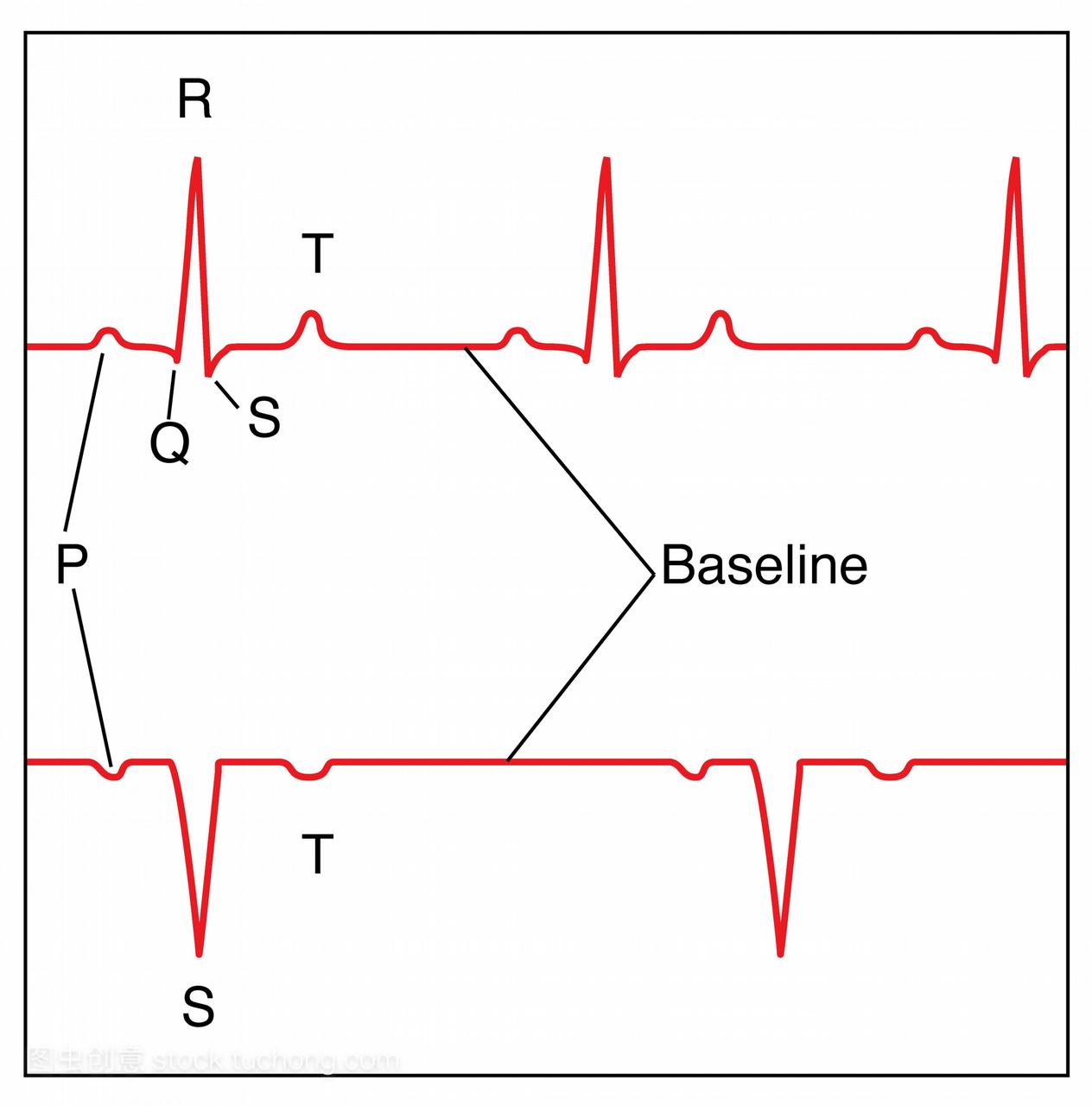 心电图ecg的正常心率,艺术作品。心电图