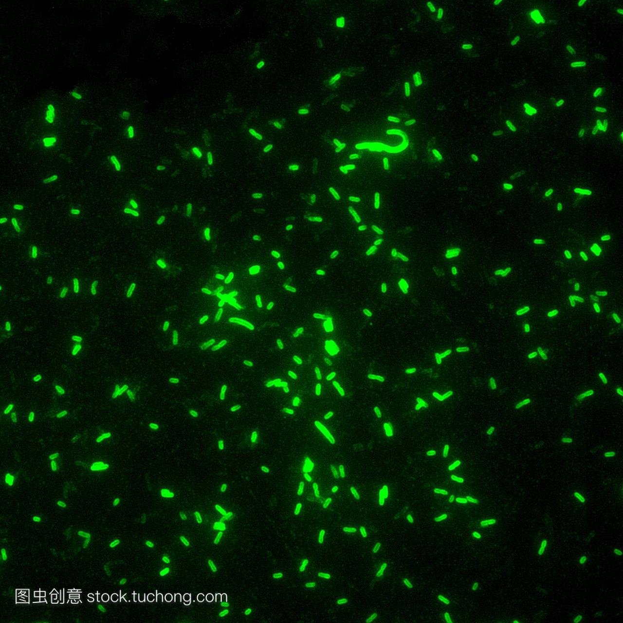 鼠疫杆菌鼠疫耶尔森菌,荧光显微照片。这些是
