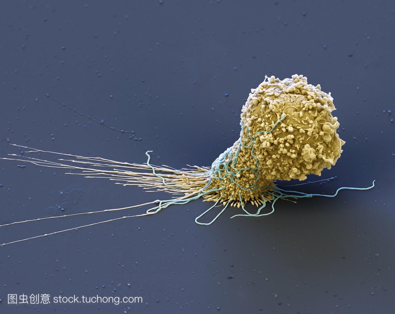 巨噬细胞吞噬细菌。一种巨噬细胞白细胞黄色的