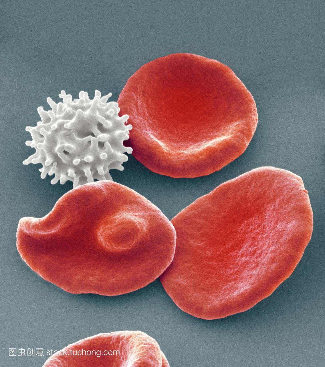 红细胞。正常健康红细胞红色和crenated血红细
