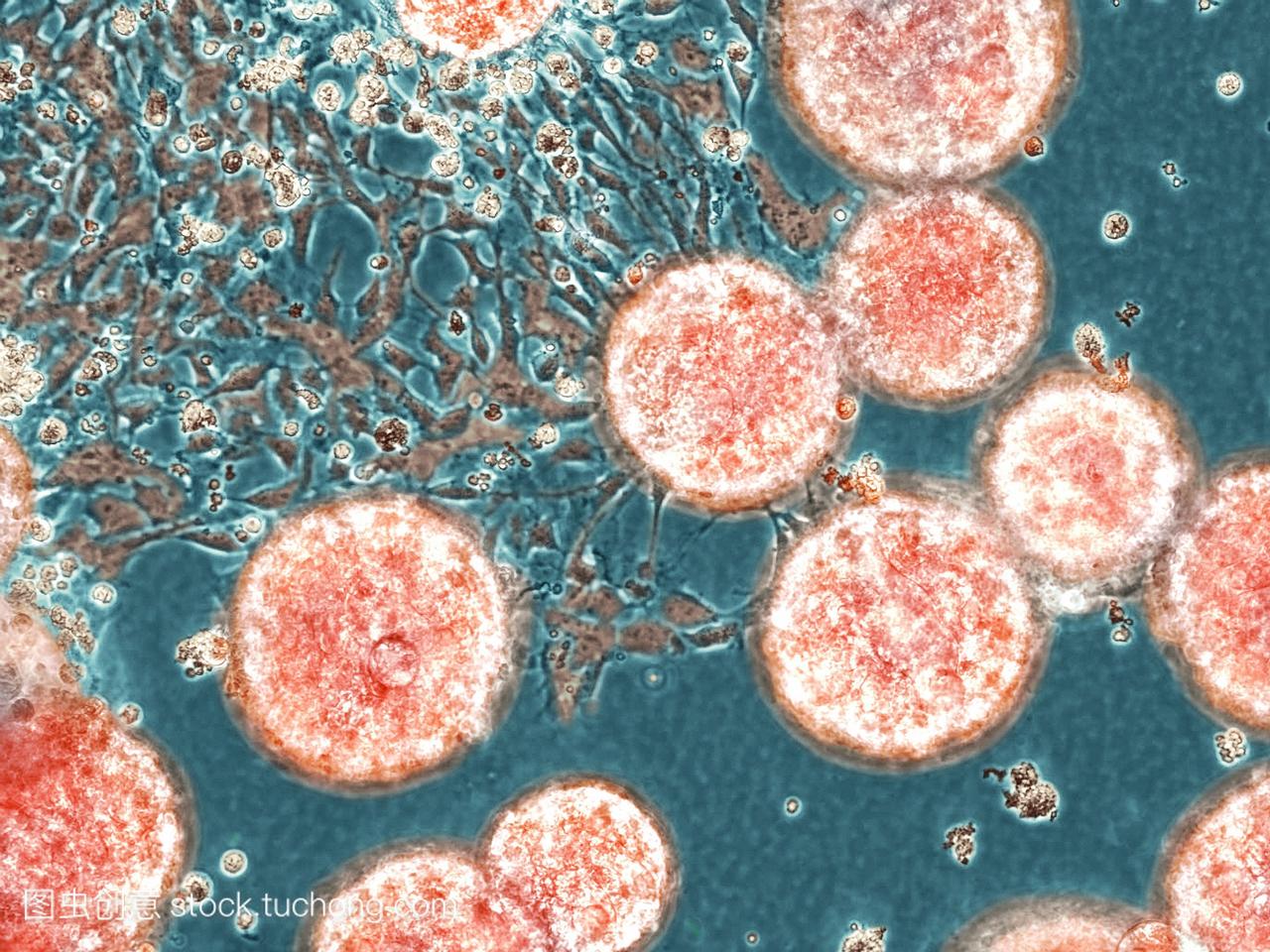 干细胞。彩色光显微摄影接受自发分化的干细胞