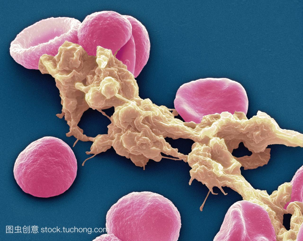红细胞和血小板。彩色扫描电镜sem人的红细胞
