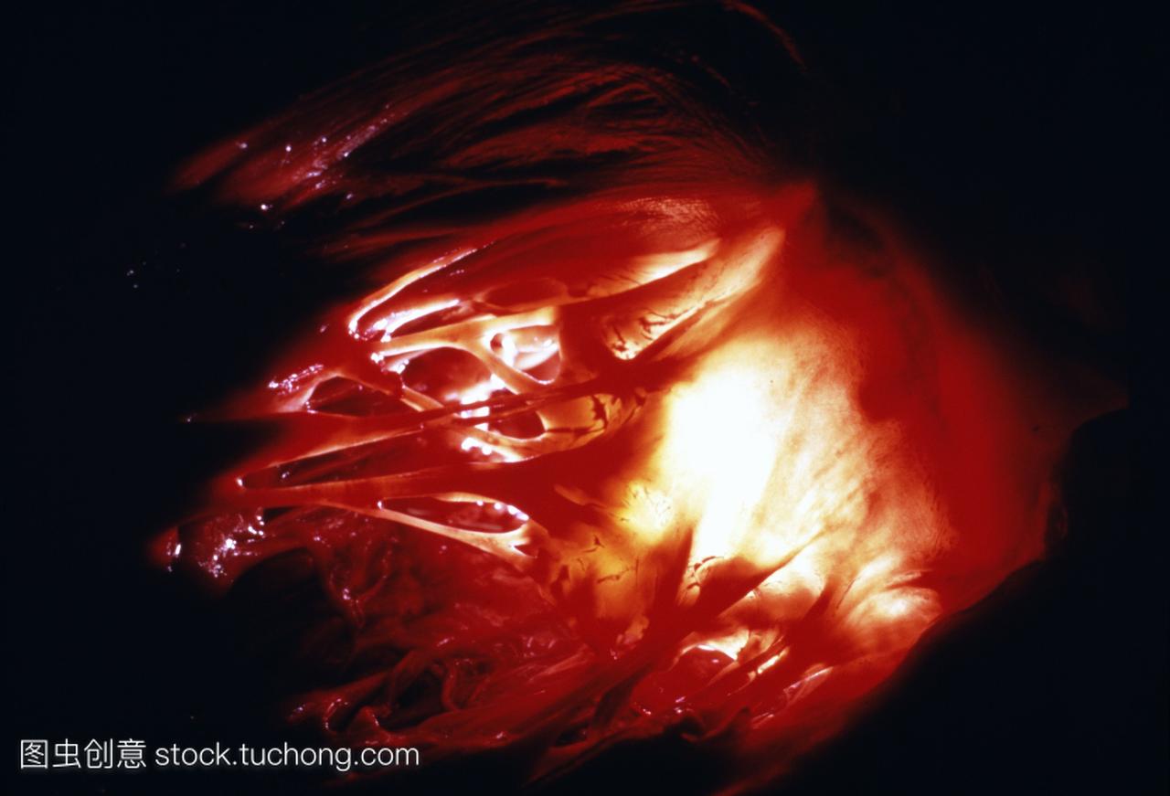 宏观人类二尖瓣心脏瓣膜的照片控制流入左心室