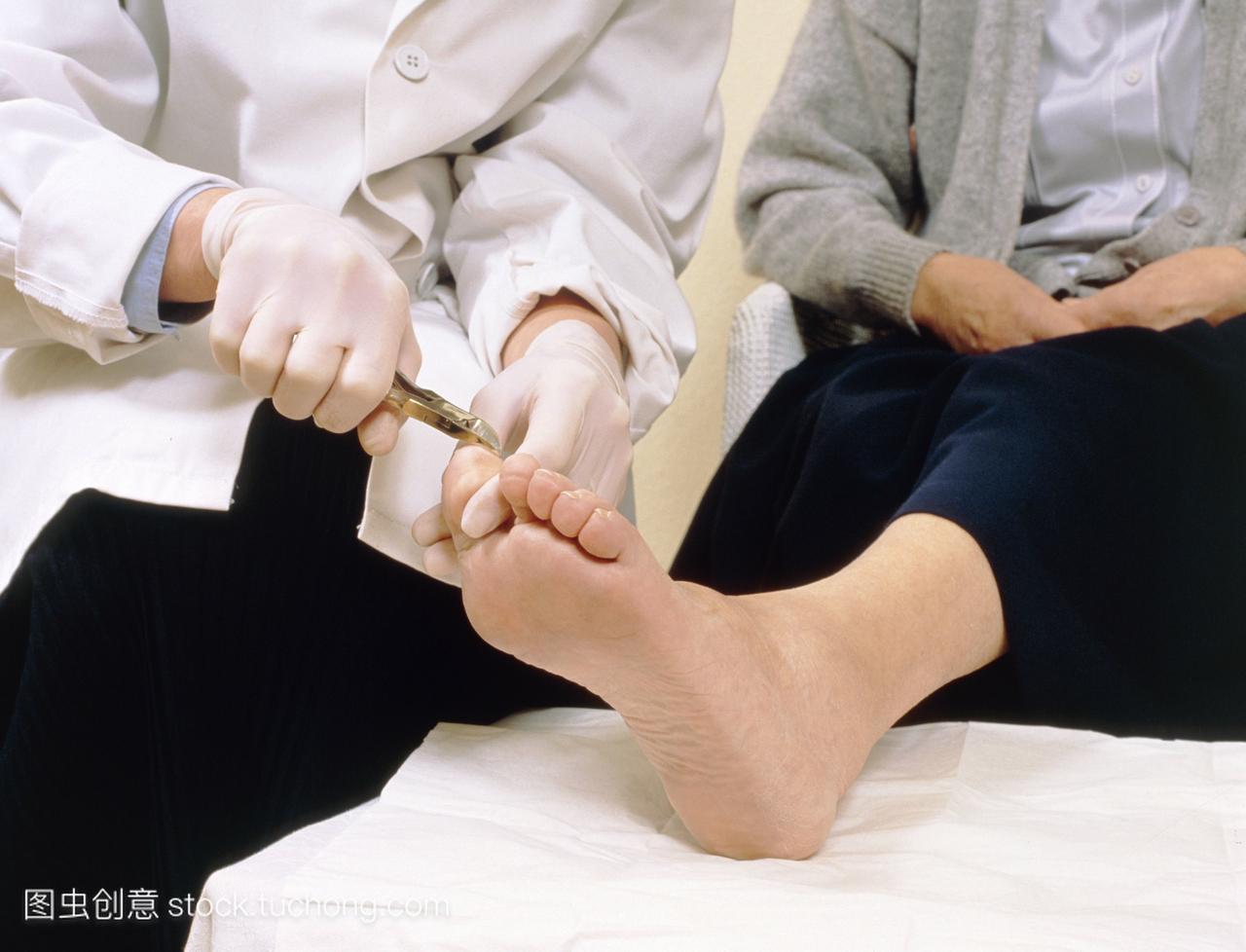 脚病治疗足科医生剪辑一个上了年纪的病人病人