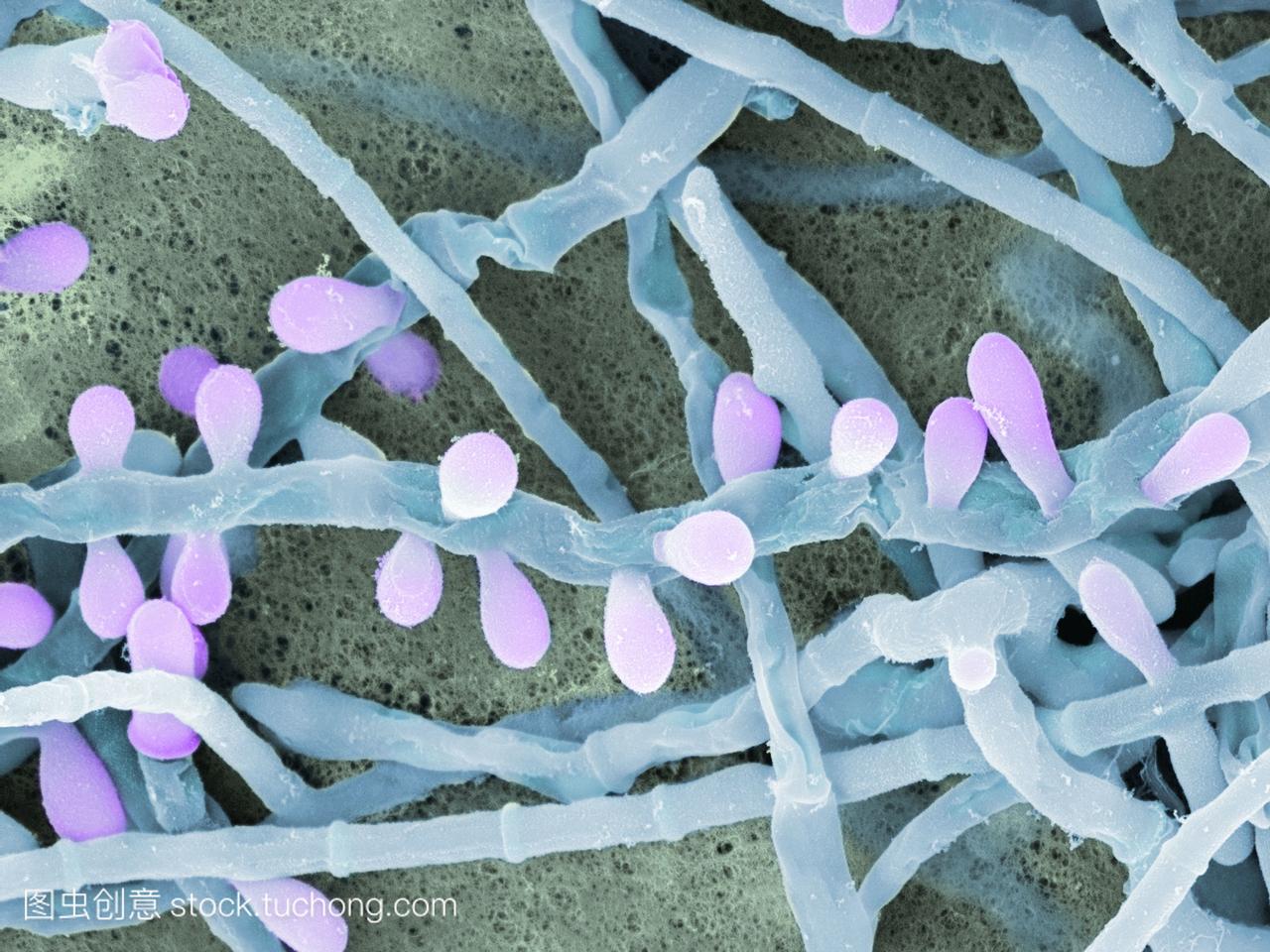 皮肤真菌真菌。彩色扫描电子显微镜sem的皮肤