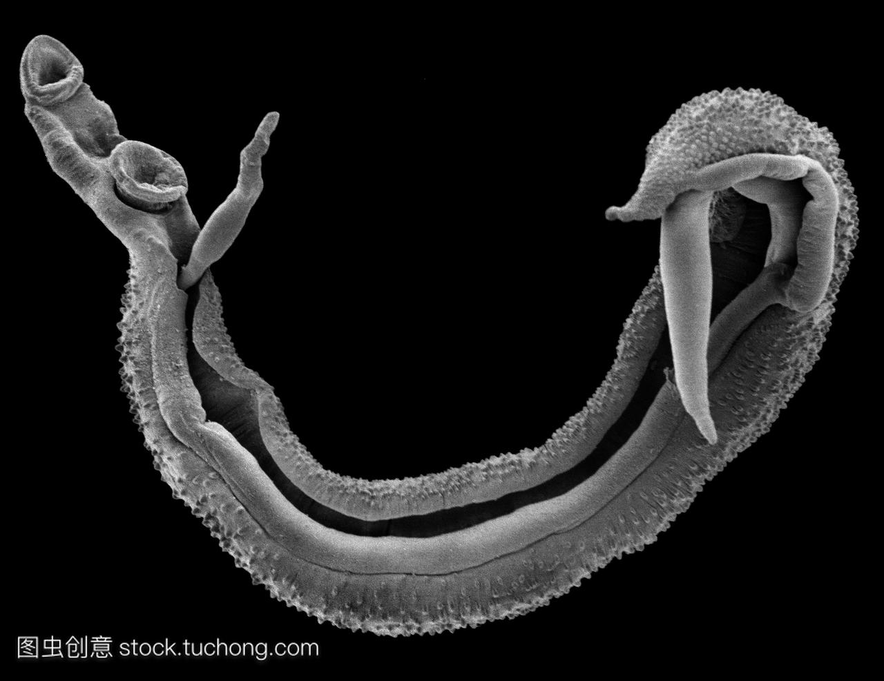 血吸虫侥幸扫描电子显微摄影sem的血吸虫血吸