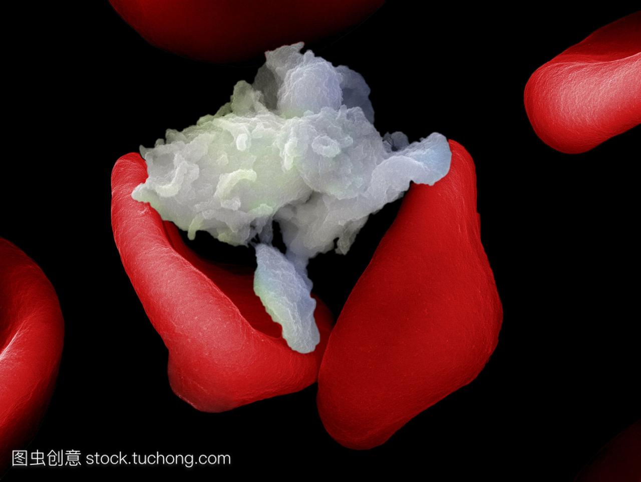 红细胞和血小板。人类红细胞红细胞,红色和血