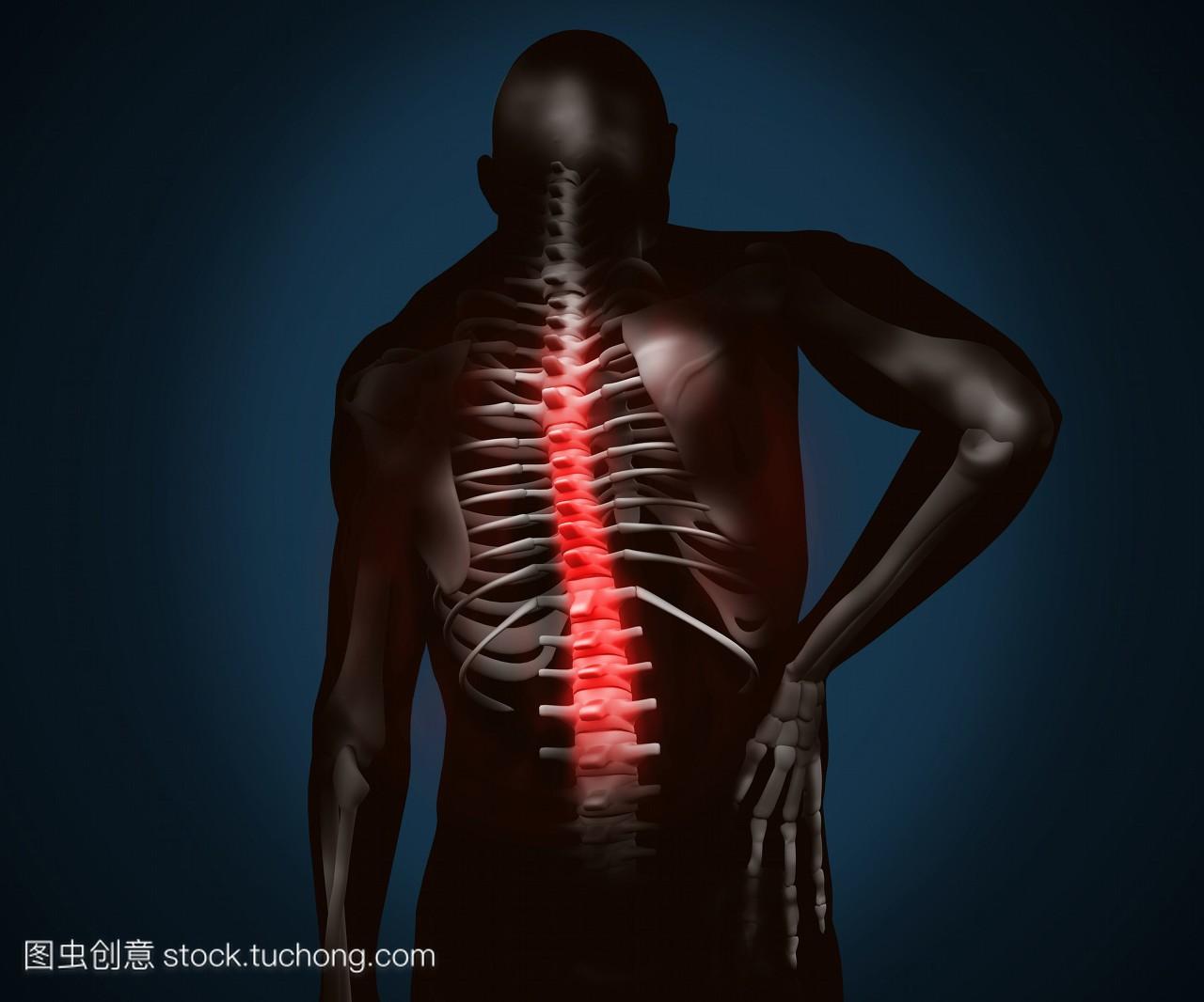 黑色数字图像显示背部疼痛
