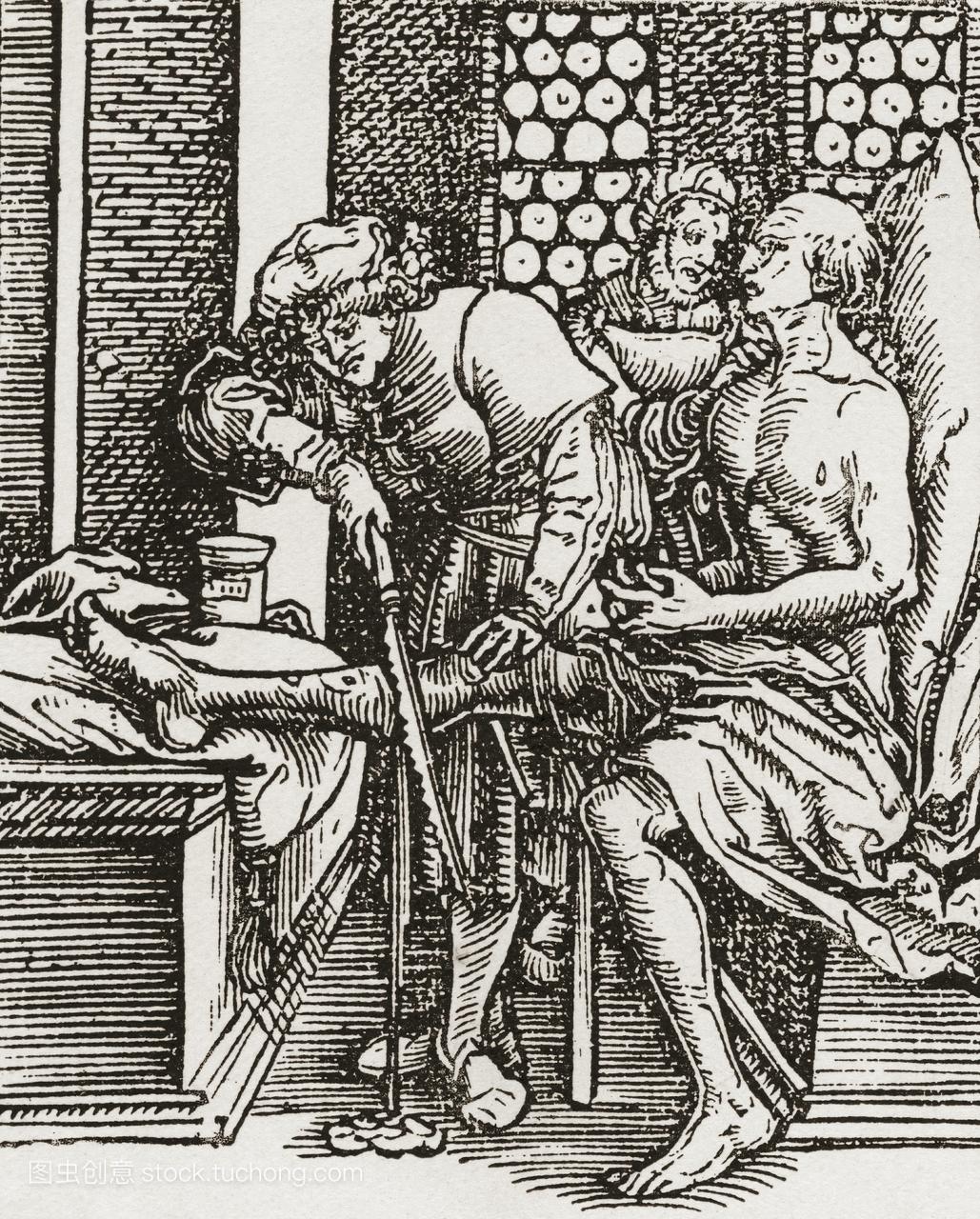 一名医生在英国都铎王朝时期执行截肢手术